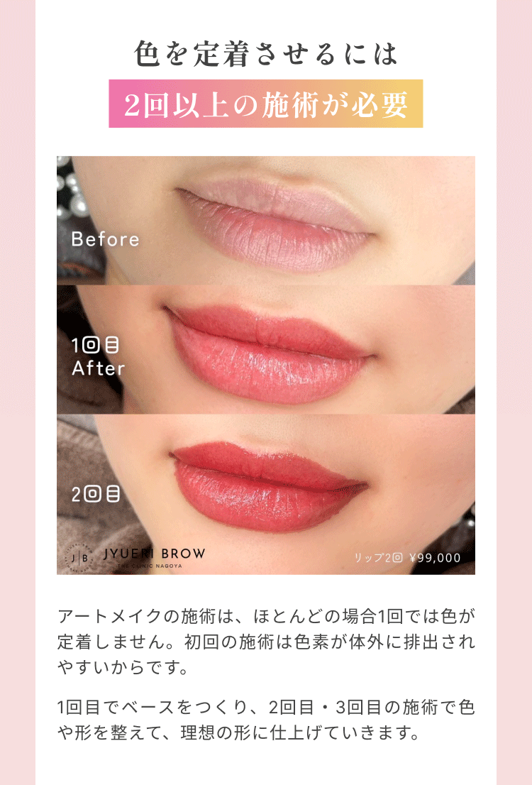 色を定着させるには 2回以上の施術が必要